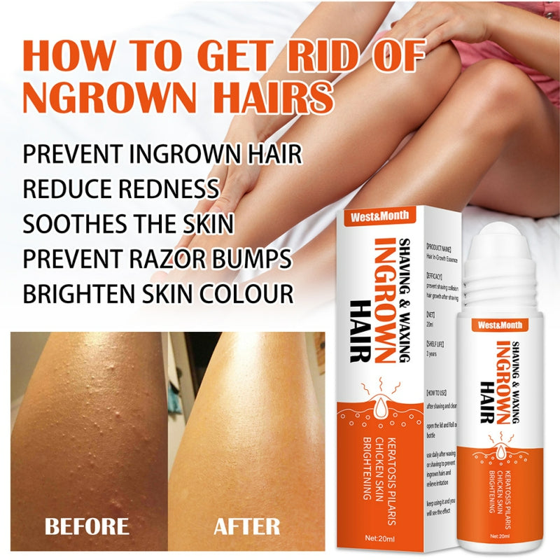 Minoxi ReACT Roll-on Hair Treatment